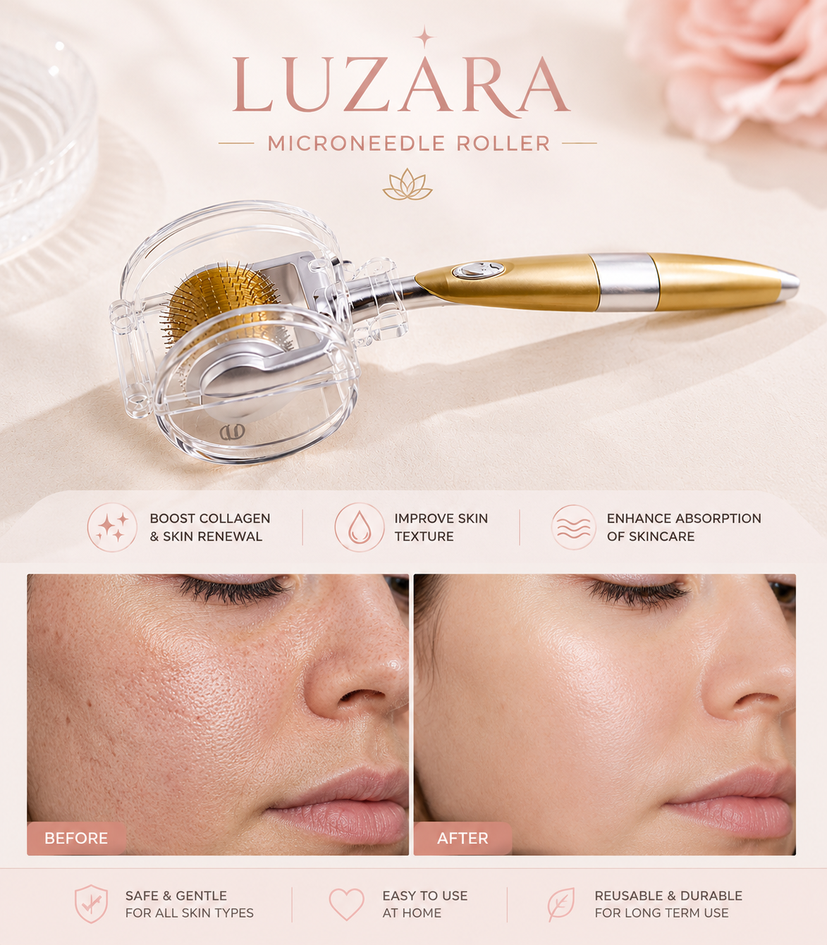 Luzara Needle Roller.